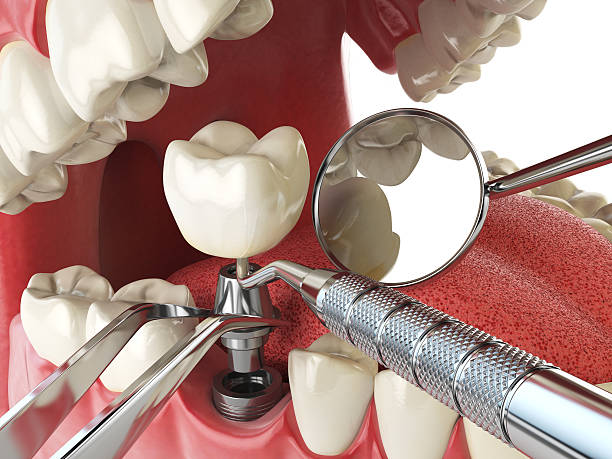 Best Emergency Dental Care for Abscessed Tooth in Three Rivers, MI