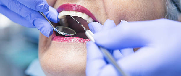 Best Emergency Dental Extractions in Three Rivers, MI
